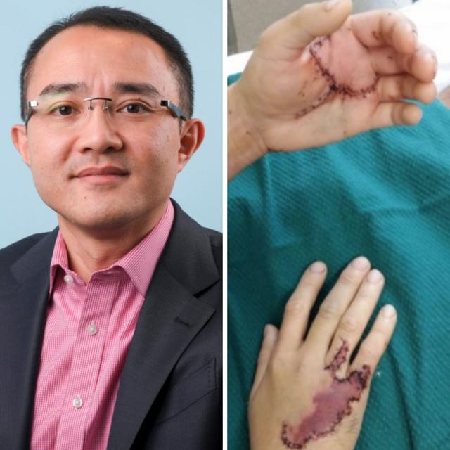 Stabbed 14 times in the hospital! - podcast episode cover