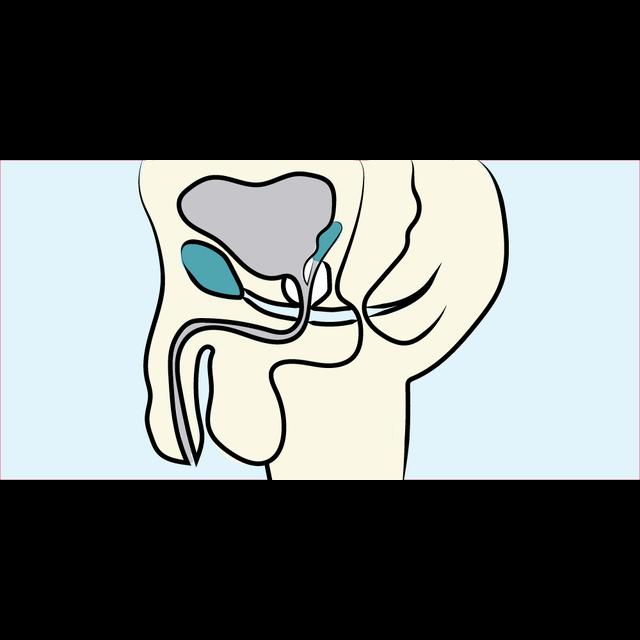 11. Urology: Hematuria - podcast episode cover
