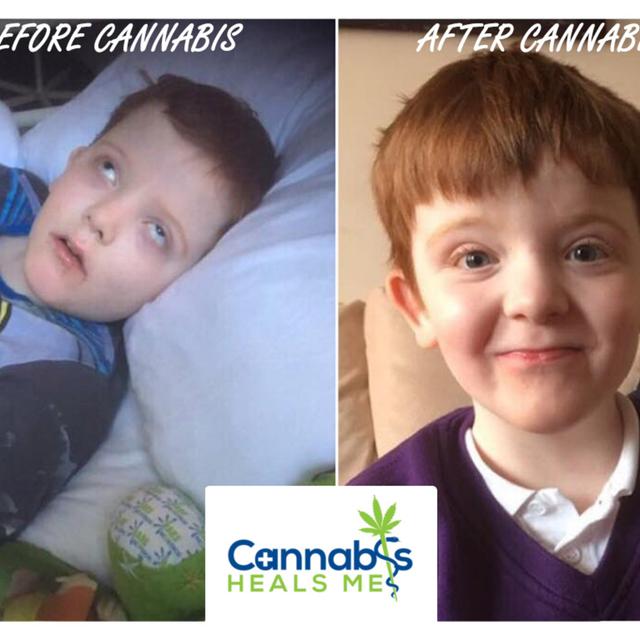 Ep. 99 - Karen Gray - Cannabis for Doose Syndrome - podcast episode cover