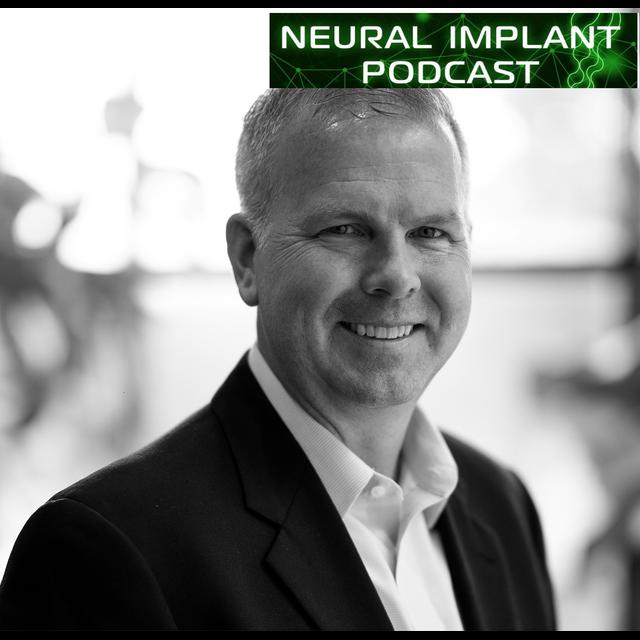 Mark Domyahn on marketing, regulatory, and reimbursement strategies for neurotech companies - podcast episode cover