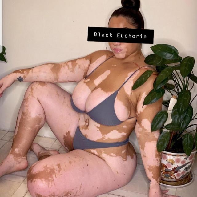 "I'm Addicted to Dick!" - Queen + Beautiful Black Skin with Vitiligo - podcast episode cover