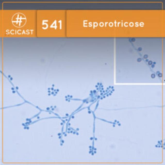 Esporotricose (SciCast #541) - podcast episode cover