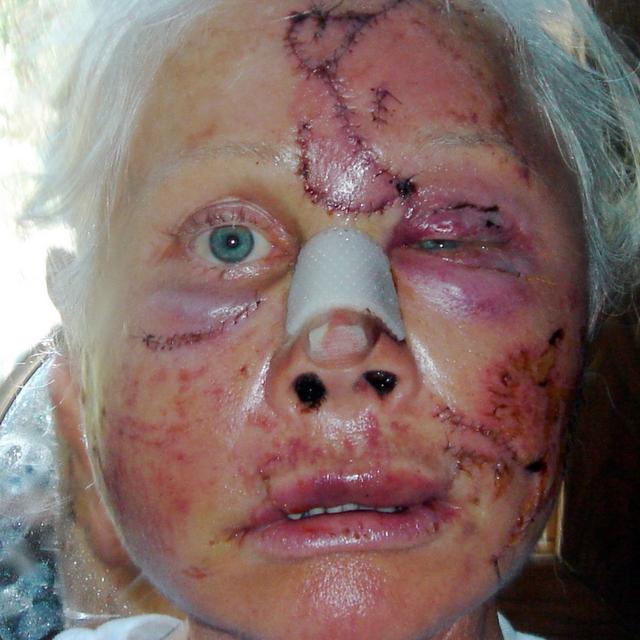 A bear ripped off my face! - podcast episode cover