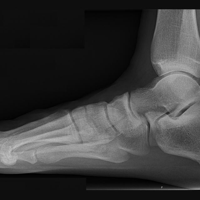 Feet of Engineering with Michael DiTullo and Jason Hanft - podcast episode cover
