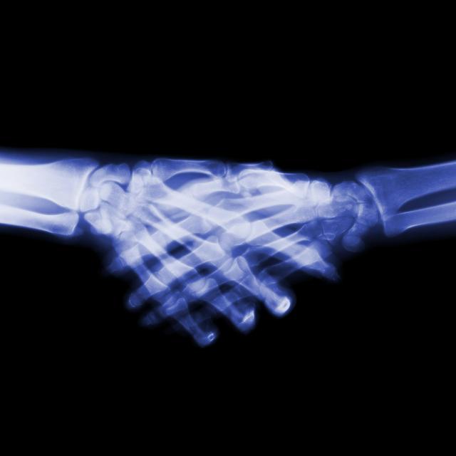 Bone Building Needs Bit of Breakdown First - podcast episode cover