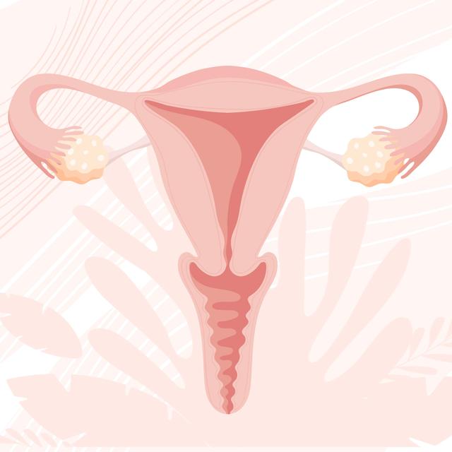 Who's At Risk For Uterine Fibroids? Most Women - podcast episode cover