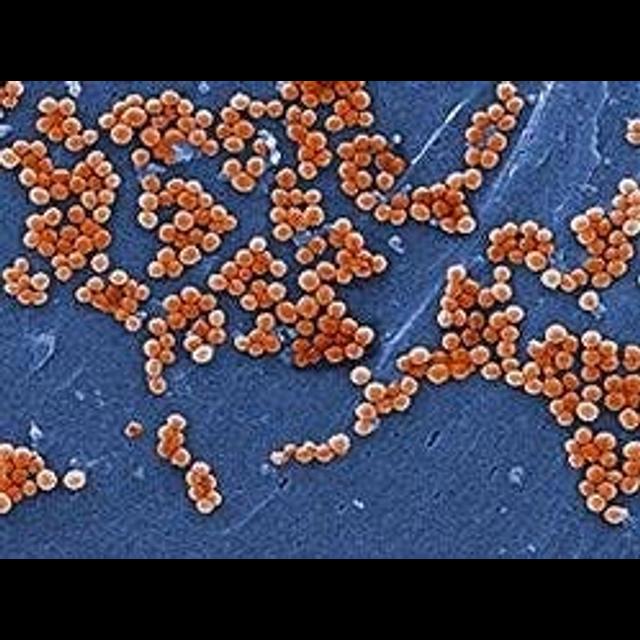 London Is Crawling with Drug-Resistant Microbes - podcast episode cover