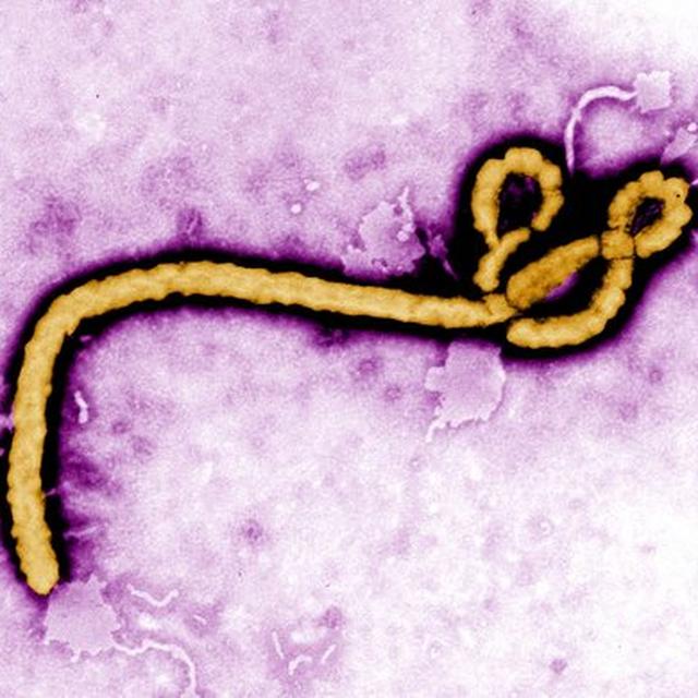 Episodio 7: Es la película "Outbreak" una representación precisa del desarrollo de las vacunas? - podcast episode cover