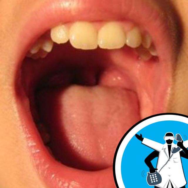 What causes sensitive teeth? - podcast episode cover