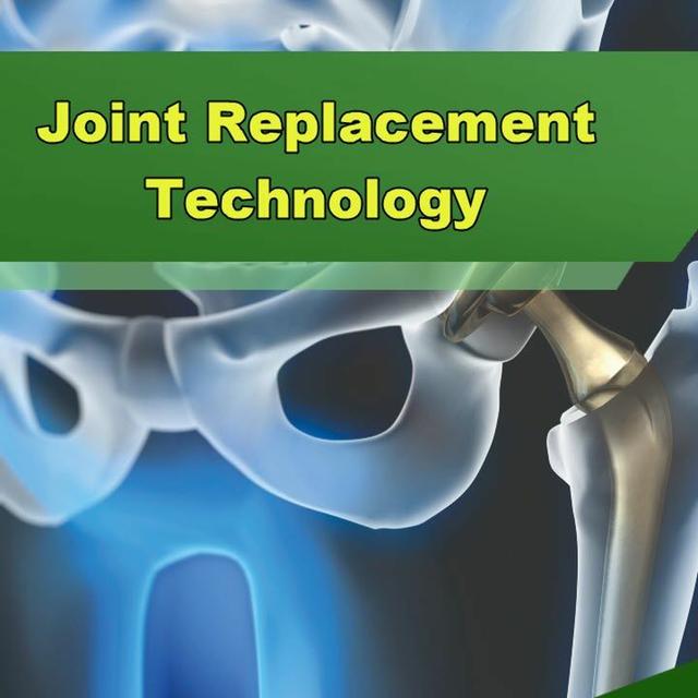 Joint Replacement Technology - Episode 290 - podcast episode cover
