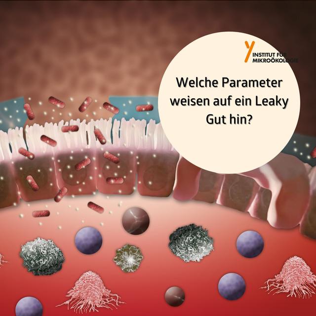 Welche Parameter weisen auf ein Leaky Gut hin? - podcast episode cover
