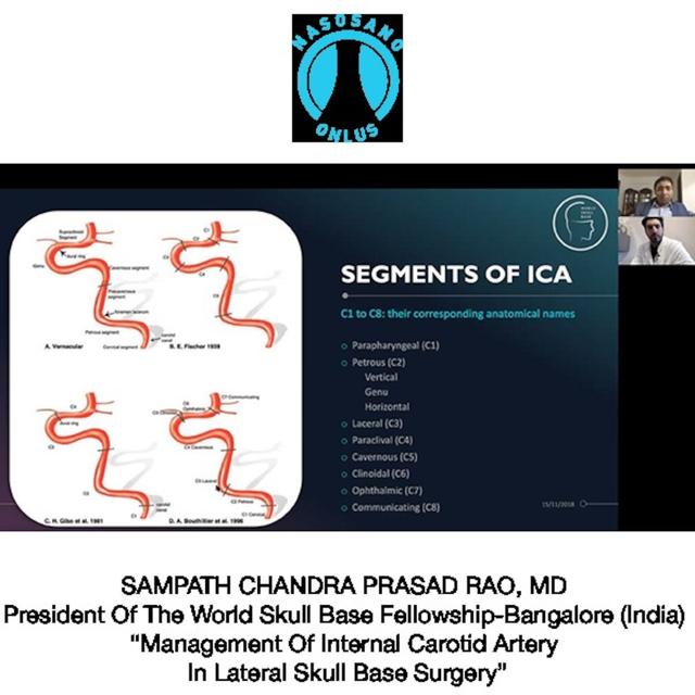 Management Of Internal Carotid Artery In Lateral Skull Base Surgery - podcast episode cover
