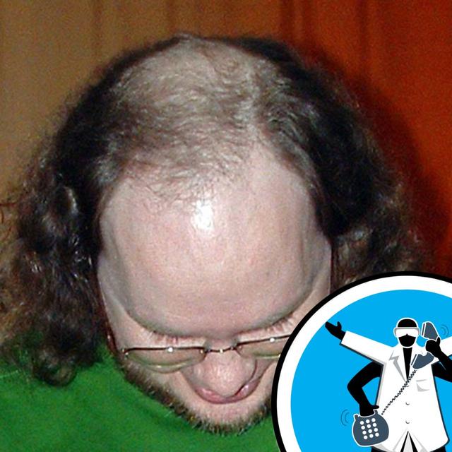 How do hair transplants work? - podcast episode cover