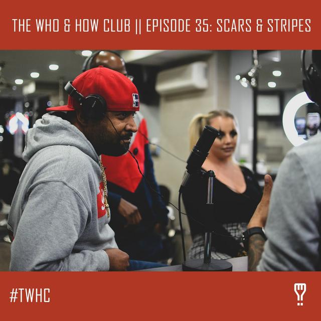 Episode 35: Scars & Stripes (Pt. 1) - podcast episode cover