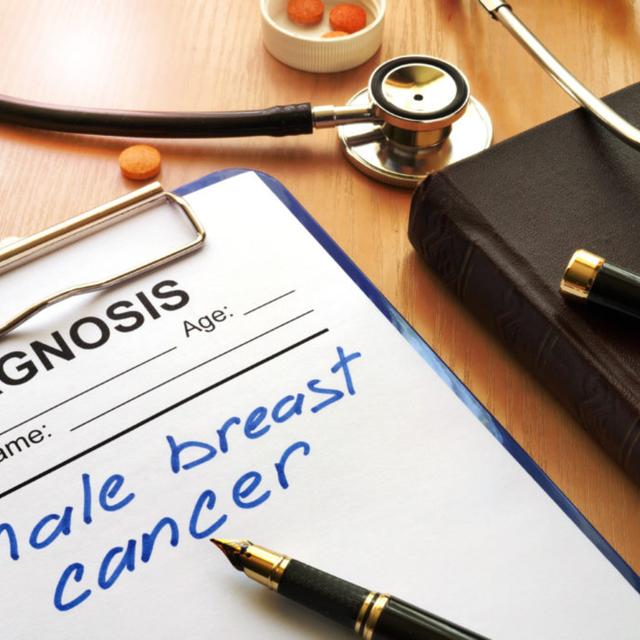 Male breast cancer survivor - podcast episode cover