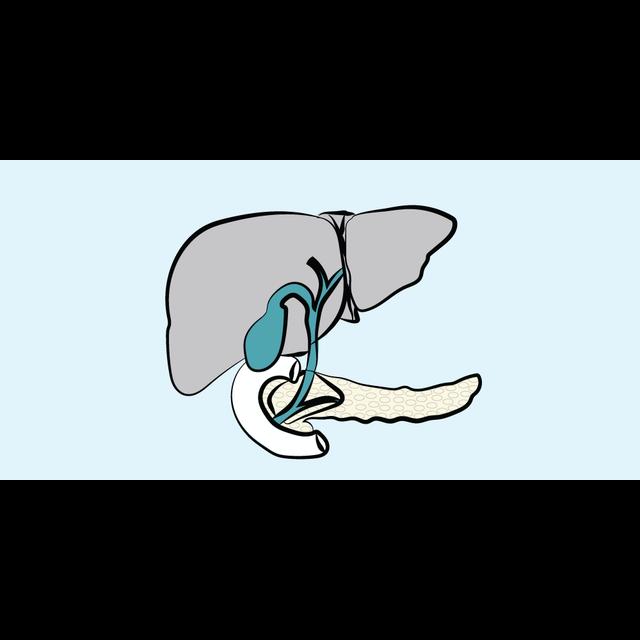 25. Liver Transplantation - podcast episode cover