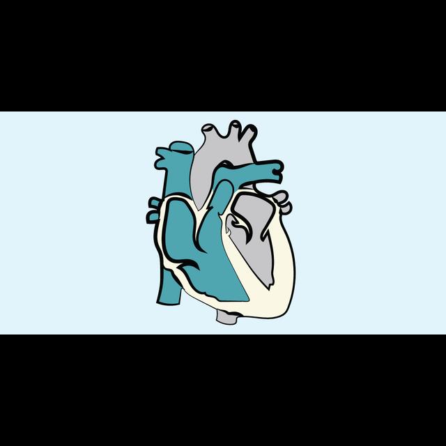 24. Heart Transplantation - podcast episode cover