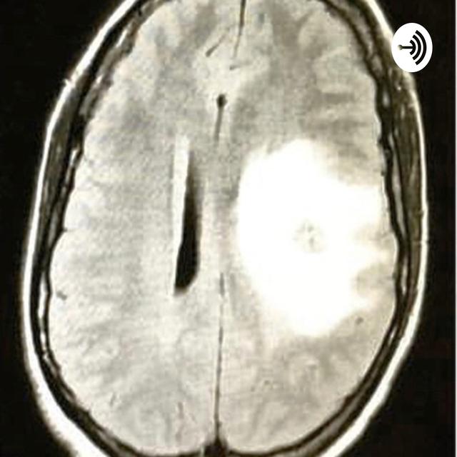How to Prep for Brain Surgery - podcast episode cover