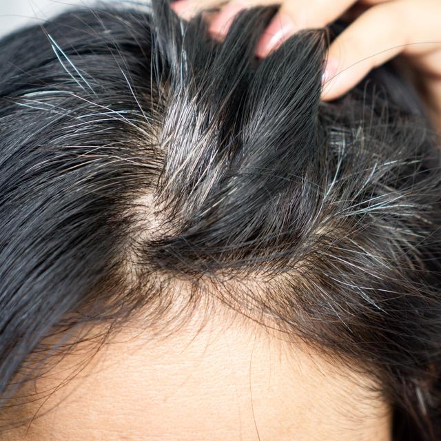 738: Unlocking the Science of Gray Hair with Arey - podcast episode cover