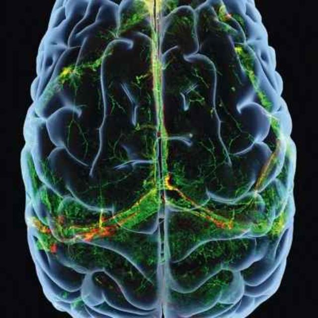 Acute dose-dependent effects of lysergic acid diethylamide in a double-blind placebo-controlled study in healthy subjects - podcast episode cover
