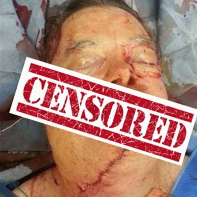 I sliced off my face with a chainsaw! - podcast episode cover