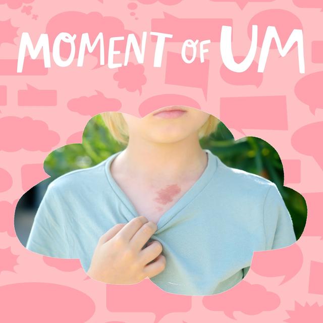 What are birthmarks? - podcast episode cover
