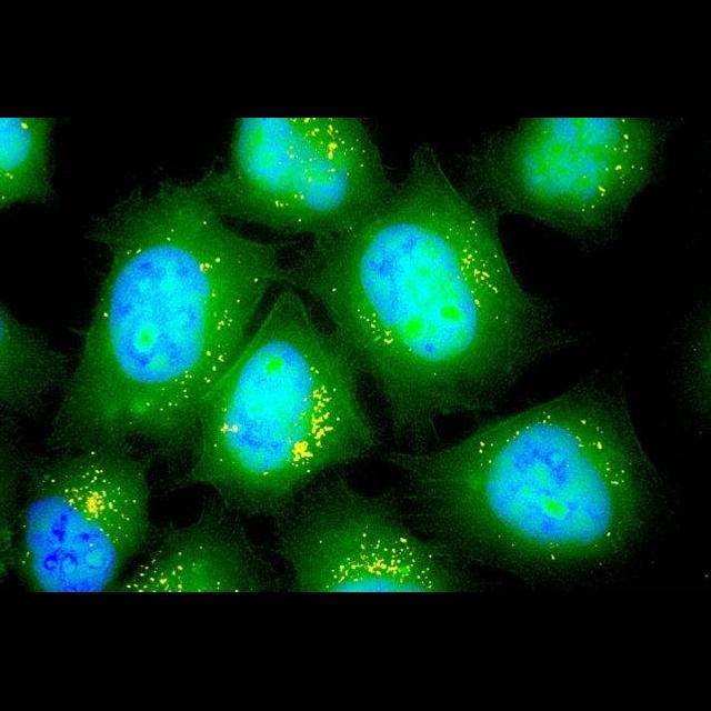 Inhaled RNA Might Help Heal Cystic Fibrosis - podcast episode cover
