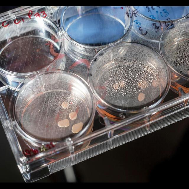 Lab-Grown Human Mini Brains Show Brainy Activity - podcast episode cover