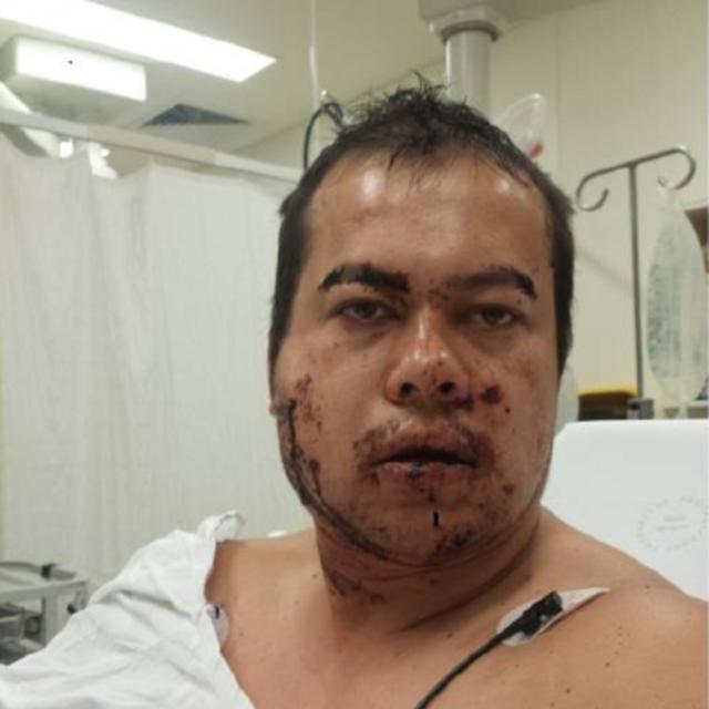 "I was shot in the face by a stranger" - podcast episode cover