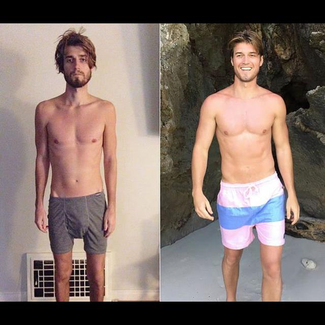 Dane Johnson - Crohn's Colitis, IBD, and Coming Back from Near Death - podcast episode cover
