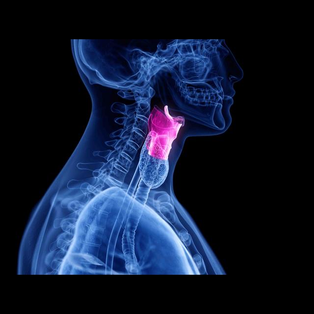 383. Vocal Fold Paralysis - podcast episode cover