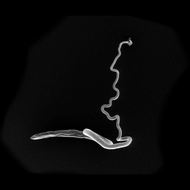 Gut Parasites Have Their Own Gut Microbiomes - podcast episode cover