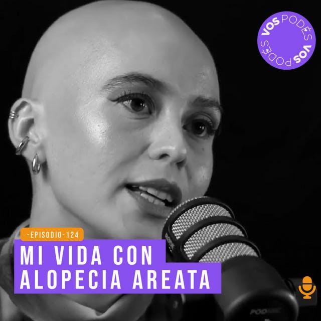 Mi vida con alopecia areata - invitada: Mafe Benitez - podcast episode cover