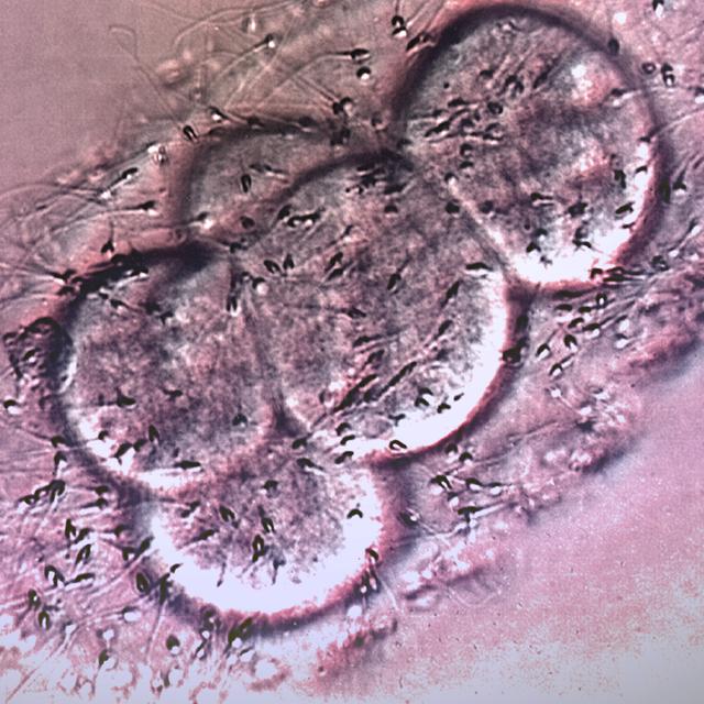 IVF Has Come A Long Way, But Many Don't Have Access - podcast episode cover