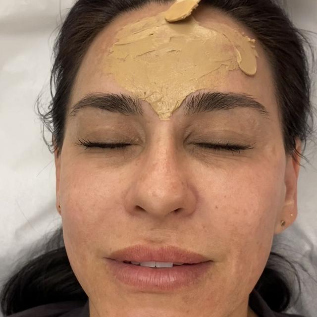 705: Get Rid of Winter Dullness with Chemical Peels - podcast episode cover
