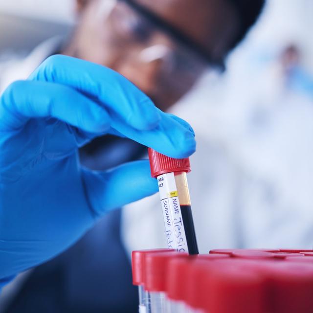 Detecting cancer using artificial intelligence - podcast episode cover