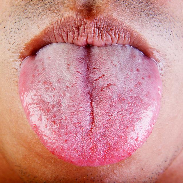 Mouth Sets Healing Standard - podcast episode cover