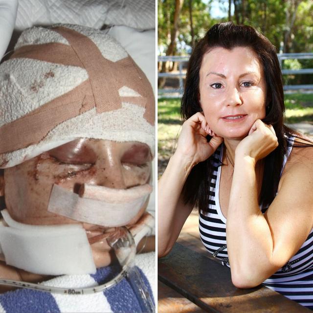 "I was bashed with a baseball bat" - podcast episode cover