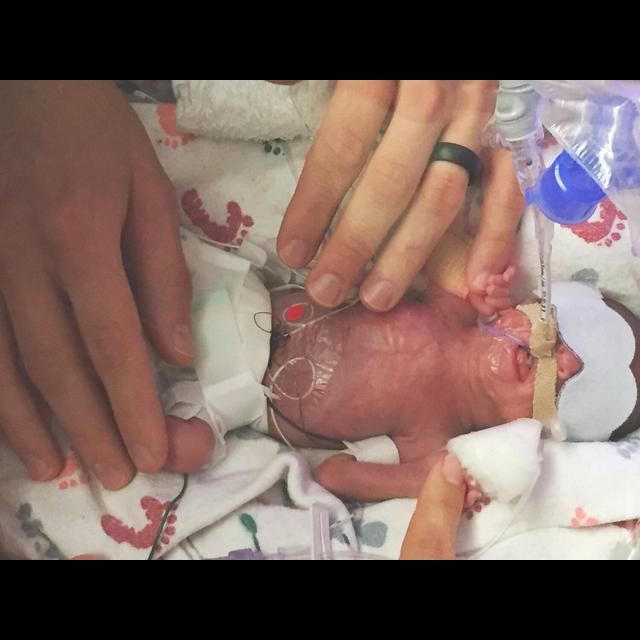 Episode 4: The Difference One Day Can Make in the NICU - podcast episode cover