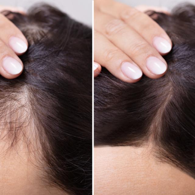 562: Hair loss, Health, and Restoration: Expert guide to Hair Wellness with Dr. Bauman - podcast episode cover