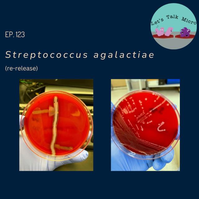 123: Streptococcus agalactiae (re-release) - podcast episode cover