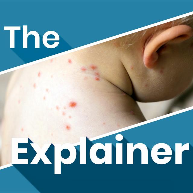 Why is measles on the rise again? - podcast episode cover