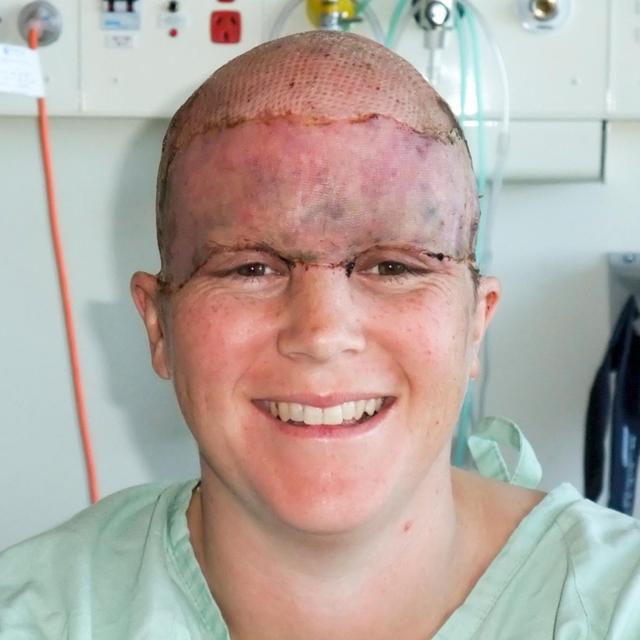 "I was scalped at 13 weeks pregnant" - podcast episode cover