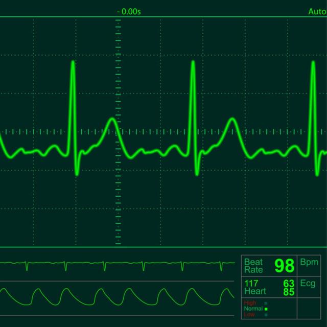 What is this Heart Test for? - podcast episode cover