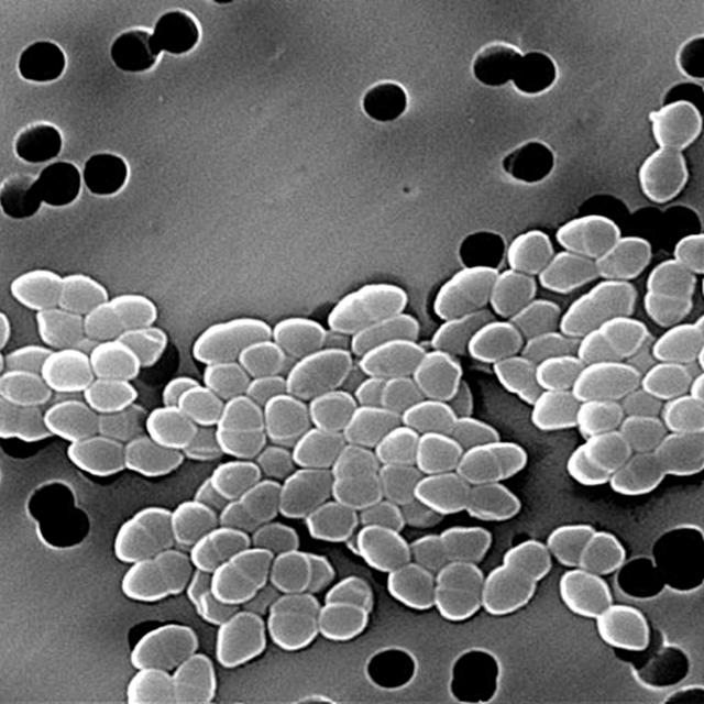Re-thinking the theory of autoimmunity in the era of the microbiome - podcast episode cover