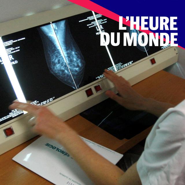 Cancers : pourquoi les jeunes sont-ils de plus en plus touchés ? - podcast episode cover