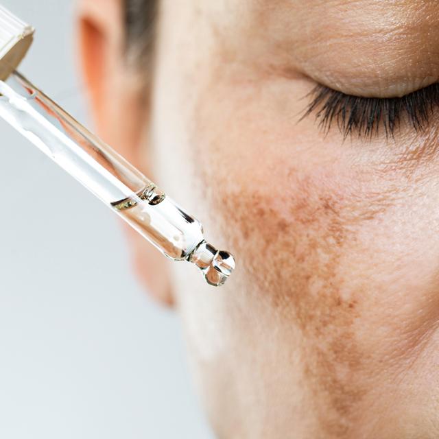645: How to Prevent & Treat Hyperpigmentation - podcast episode cover