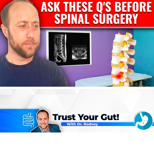 Ask These Questions Before Getting Back Surgery - podcast episode cover