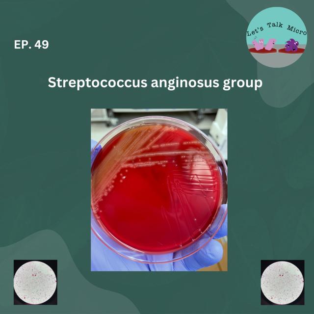 TBT: Streptococcus anginosus group - podcast episode cover
