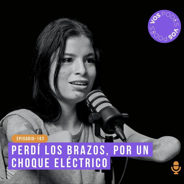 Perdí los brazos por un choque eléctrico - invitada: Karol Bastidas - podcast episode cover